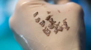 Greffe cheveux Casablanca | Clinique transplantation capillaire Maroc